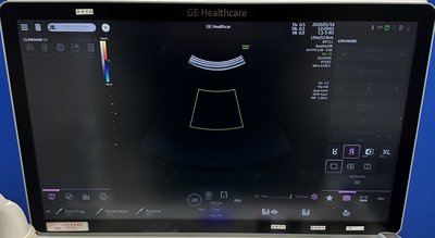 超音波診断装置&nbsp;|&nbsp;GEヘルスケア・ジャパン株式会社&nbsp;|&nbsp;Voluson Swift BT23の写真