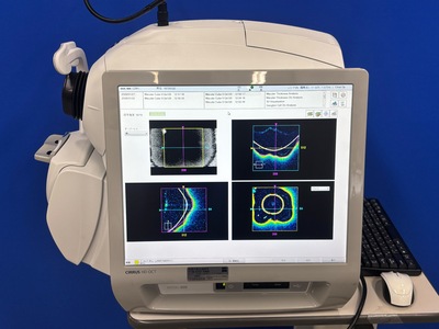 OCT&nbsp;|&nbsp;Carl Zeiss&nbsp;|&nbsp;Cirrus 500 HD-OCT Plus
