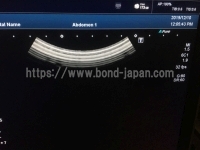 超音波診断装置/カラードプラ | キャノンメディカル株式会社 | Aplio 400の写真