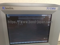 超音波診断装置 | 株式会社富士フイルムソノサイト | sonosite TITANの写真