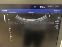超音波診断装置/カラードプラ | キャノンメディカル株式会社 | TUS-X100 Xario 100の写真