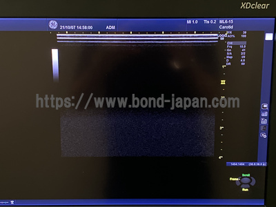 超音波診断装置/カラードプラ  | GEヘルスケア・ジャパン株式会社 | Logiq S8 XDclearの写真