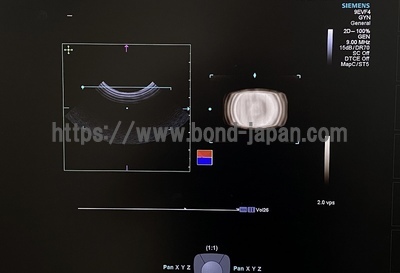 超音波診断装置 | 持田シーメンスメディカルシステム株式会社 | Acuson S1000の写真