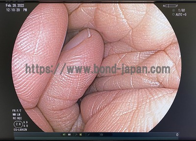 上部消化管ビデオスコープ（レザリオ専用） | 富士フイルムメディカル株式会社 | EG-L600ZWの写真