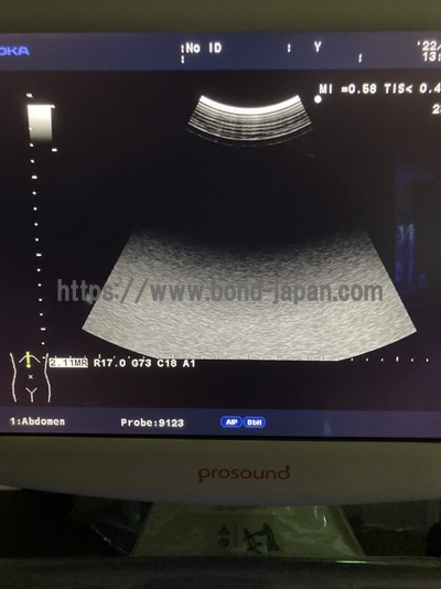Color Doppler | HITACHI | Prosound α6