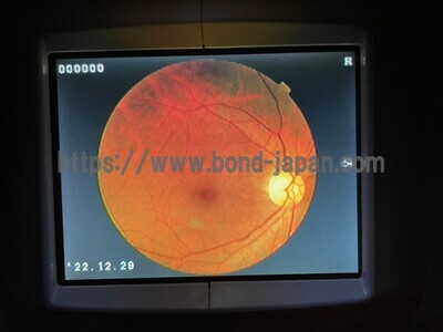 Fundus Camera | TOPCON | TRC-NW200