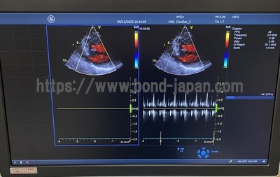 超音波診断装置（循環器向け） | SBJ | 18066
