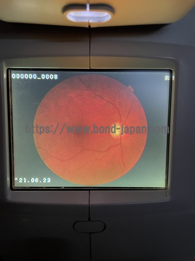 Fundus Camera | TOPCON | TRC-NW200