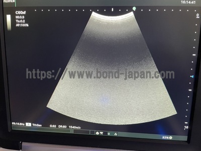 ポータブル　超音波診断装置/カラードプラ | 富士フイルムメディカル株式会社 | FC1-Xの写真