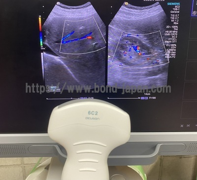 Ultrasound | SIEMENS | Acuson S1000