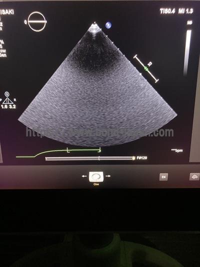 Ultrasound | PHILIPS | EPIQ 7G