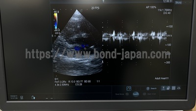 超音波診断装置 | 日立製作所 | Arietta 65の写真