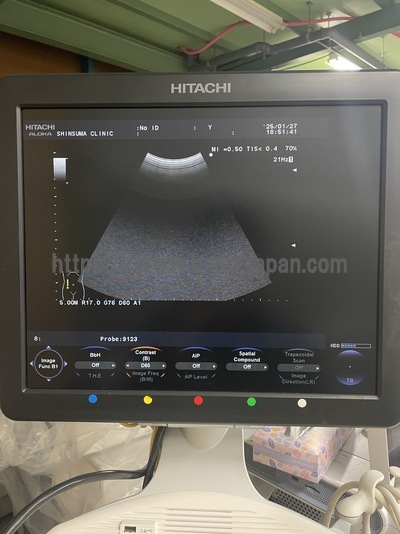 Color Doppler | HITACHI | F37