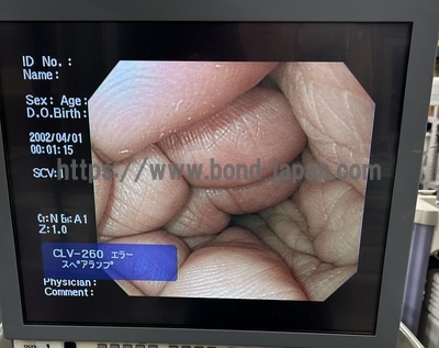 Video Gastroscope | OLYMPUS | GIF-Q260