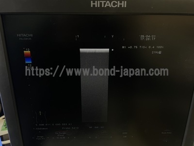 Color Doppler | HITACHI | F37