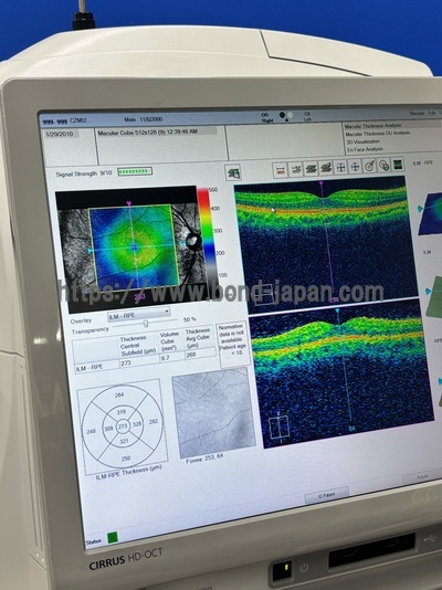 ** Great Conditioned OCT** | Carl Zeiss | Cirrus 500 HD-OCT Plus