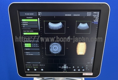 4D Ultrasound | GE | Voluson P8 BT16