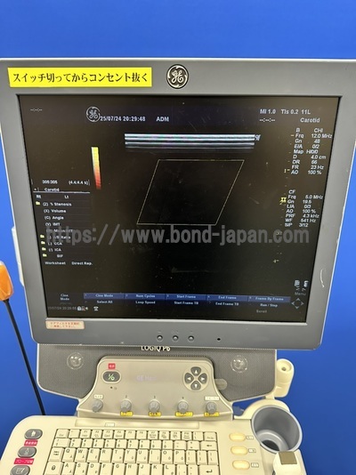 Color Doppler | GE | LOGIQ P6