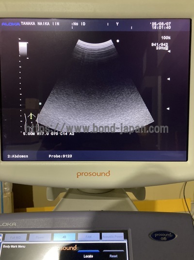 Color Doppler | HITACHI | Prosound α6