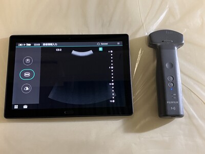Ultrasound&nbsp;|&nbsp;FUJIFILM&nbsp;|&nbsp;iViz air Convex