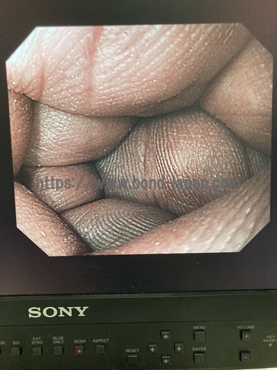 Endoscopy System | OLYMPUS | LUCERA ELITE CV-290