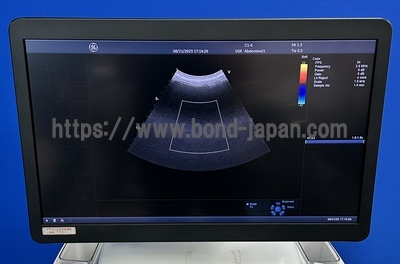 Color Doppler | GE | Vivid E95 Urtla Edition
