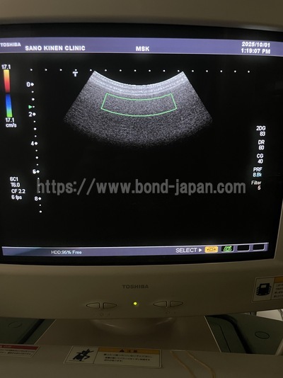 Ultrasound Color Doppler | CANON | SSA-700A Aplio50