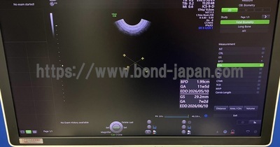 4D Ultrasound | GE | Voluson E10 BT18