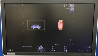 4D Ultrasound&nbsp;|&nbsp;GE&nbsp;|&nbsp;Voluson E10 BT18