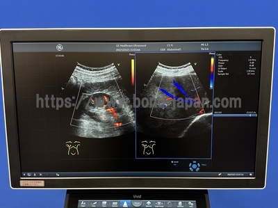 Ultrasound | GE | Vivid S60N