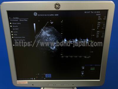 Color Doppler | GE | LOGIQ S8