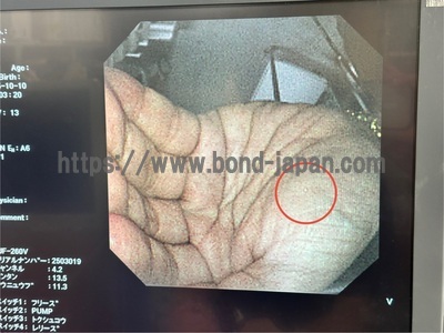 Video Duodenoscope | OLYMPUS | TJF-260V