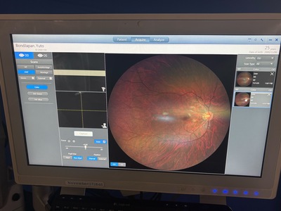 Ultra-widefield (UWF) Imaging System | Carl Zeiss | CLARUS 500