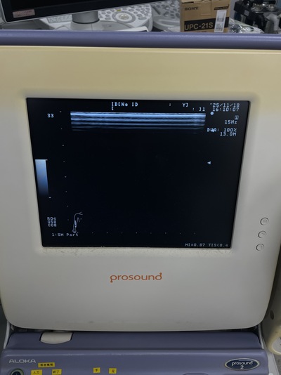 Ultrasound | HITACHI | Prosound 2