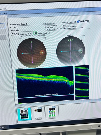 non-mydriatic retinal camera with OCT | TOPCON | 3D OCT 1 / Maestro 1