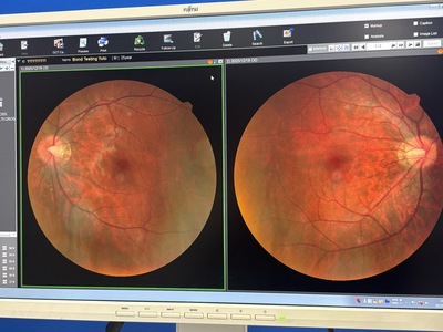 A Combination system of OCT and fundus camera&nbsp;|&nbsp;NIDEK&nbsp;|&nbsp;RS-330 Retina Scan Duo