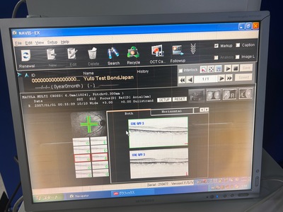 Retinal Camera and OCT Combined&nbsp;|&nbsp;NIDEK&nbsp;|&nbsp;RS-3000