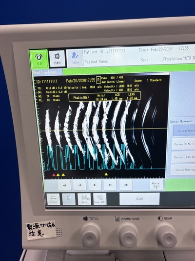 B scan&nbsp;|&nbsp;TOMEY&nbsp;|&nbsp;UD-8000 B