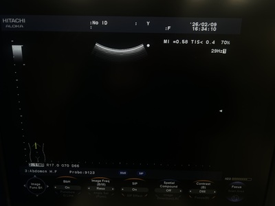 Color Doppler&nbsp;|&nbsp;HITACHI&nbsp;|&nbsp;F37