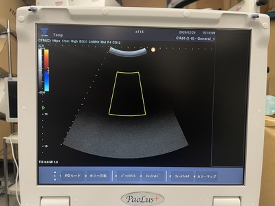 &nbsp;|&nbsp;FUKUDA DENSHI&nbsp;|&nbsp;UF-760AG+