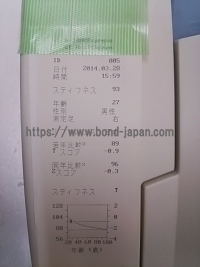 超音波骨密度測定装置 | GEヘルスケア・ジャパン株式会社 | A-1000 Expressの写真