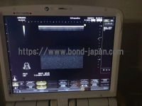 超音波診断装置 | 日立製作所 | Noblusの写真