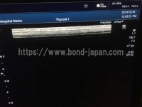 超音波診断装置/カラードプラ | キャノンメディカル株式会社 | Aplio 400の写真
