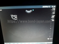 超音波診断装置 | 株式会社富士フイルムソノサイト | sonosite TITANの写真