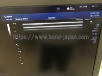 超音波診断装置/カラードプラ | キャノンメディカル株式会社 | TUS-X100 Xario 100の写真