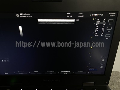 超音波診断装置 | GEヘルスケア・ジャパン株式会社 | Versana Activeの写真