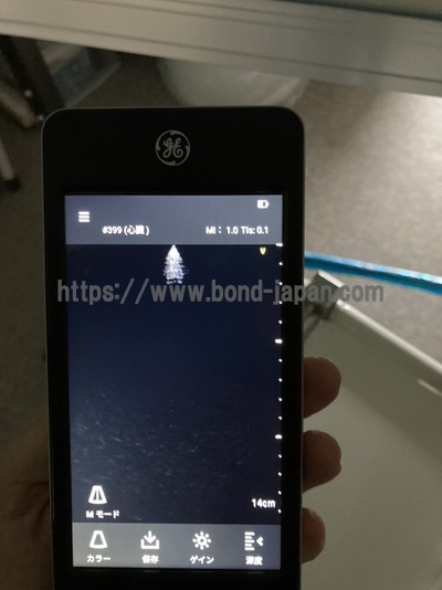 汎用超音波画像診断装置 | GEヘルスケア・ジャパン株式会社 | Vscan Extend R2の写真
