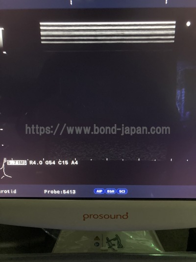Color Doppler | HITACHI | Prosound α6