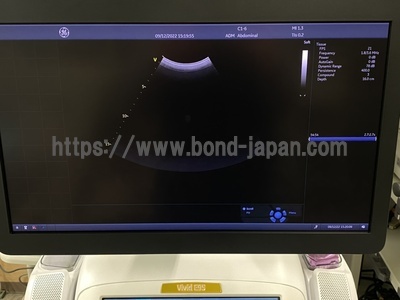 超音波診断装置（循環器向け） | GEヘルスケア・ジャパン株式会社 | Vivid E95 Urtla Editionの写真