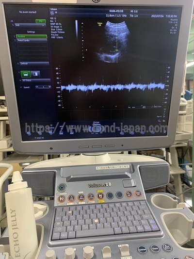 4D Ultrasound | GE | Voluson S8